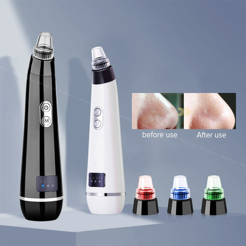 Blackhead Removal Vacuum / Pore Cleaner for Men - ManKave Gifts & Accessories